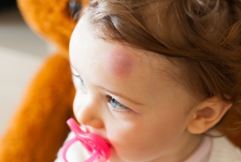 Taking Headache out of Head Injuries